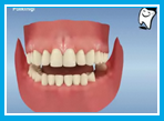 Diş kaybı ve implant