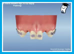 Ortodontik tedavi so.