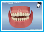 Ortodontik tedavide..