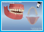 Anterior diastema k..