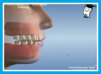 Ortodontide çekimli..